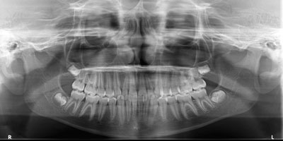 panoramica-EXAME-DDI-RADIGRAFIA-ODONTOLOGICA