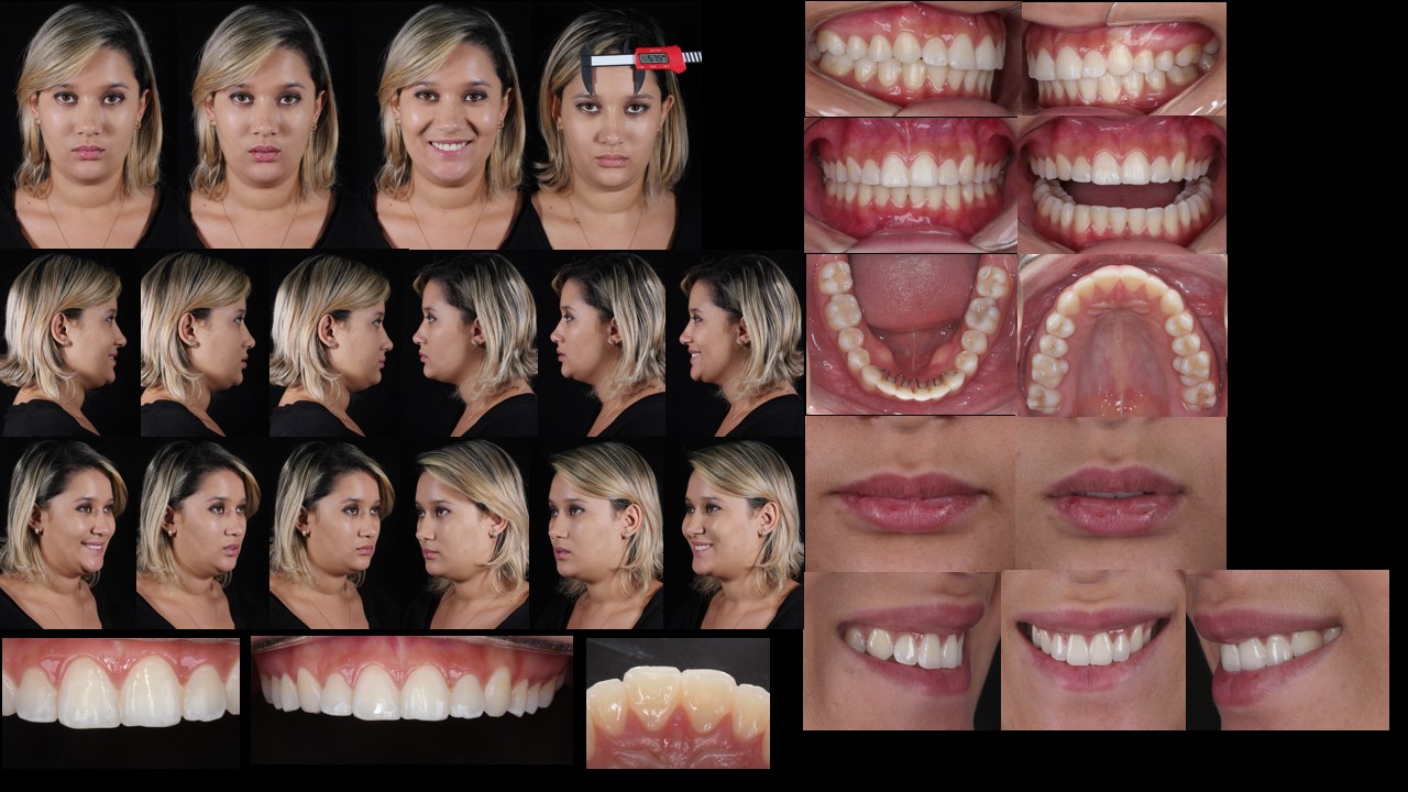 protocolo-fotografico-ddi-exame