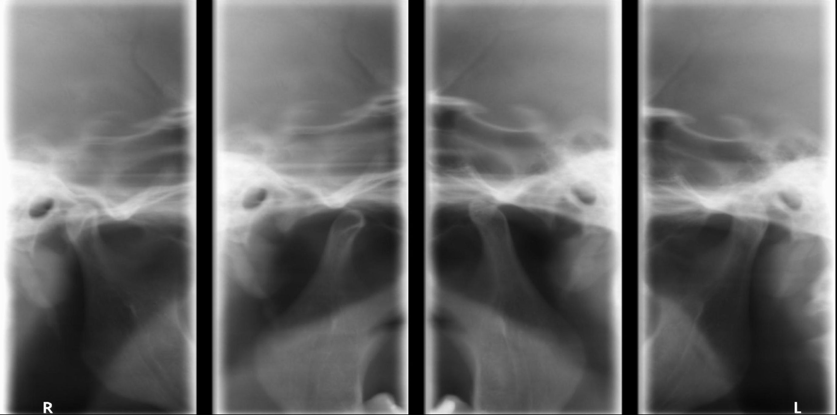 atm-exame-ddi-radiografia-odontologica